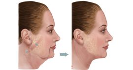 Cang Da Mat Giua Duoi