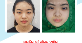 Nhan Mi Vinh Vien