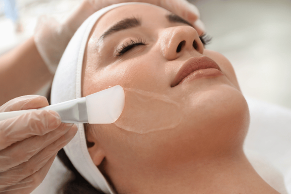 điều Trị Da Chemical Peel